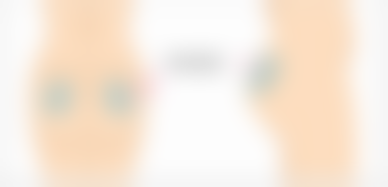 贵州利美康外科整形医院真实实例