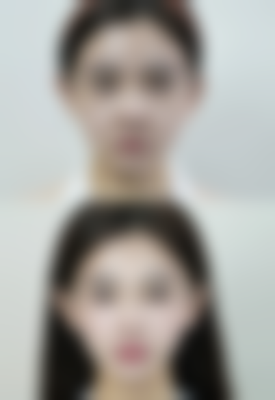 脸上疤痕影响当兵靠谱吗