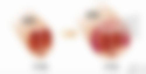 Swisse摩洛哥坚果眼霜适合去除眼袋黑眼圈吗