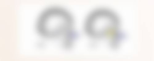 抽脂助你3个月拥有理想身材适合吗