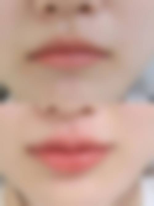 深圳微姿医疗美容整形医院擅长项目