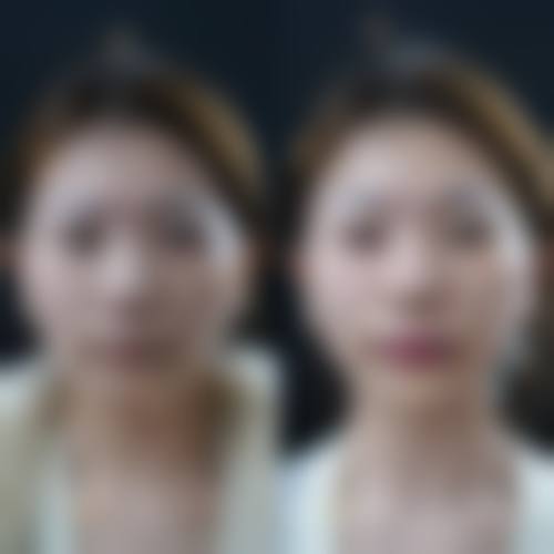 雄安王妃医疗美容医院擅长项目