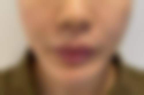 广州雪儿海蒂女性私密整形修复专科价格表