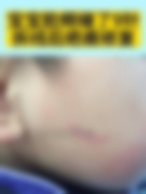 深圳微姿医疗美容整形医院电话号码