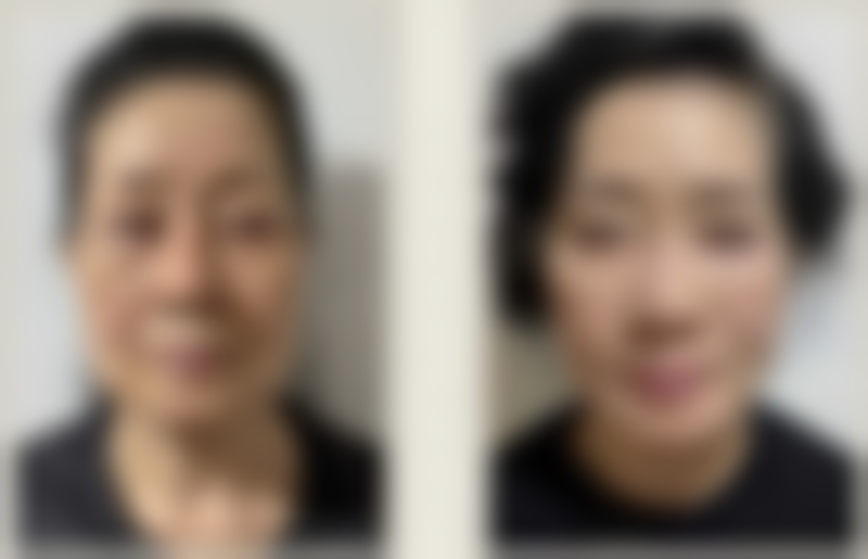 陈济槐医生技术特点