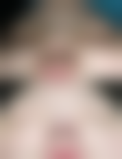 眼部基础状况对判断适不适合双眼皮有什么影响