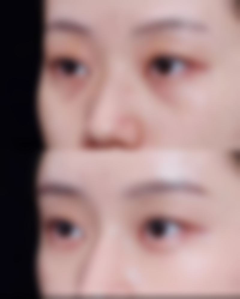 艺成整形外科价格表