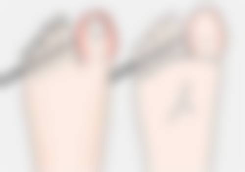 积雪苷霜软膏对手术疤痕痒止痒靠谱吗