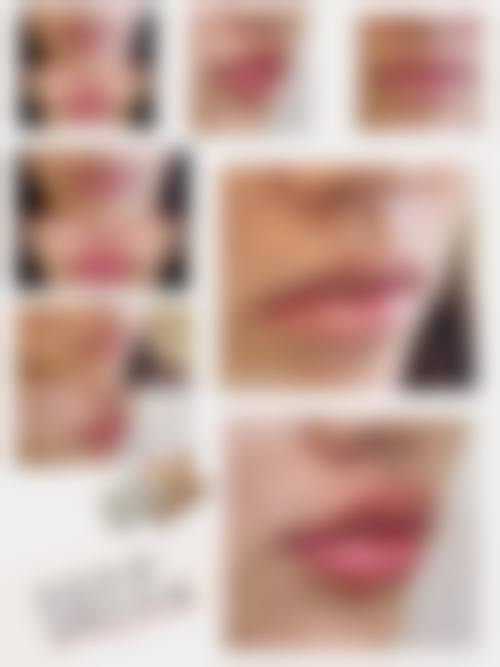 韩国摩兹（modsclinic）整形医院价格表