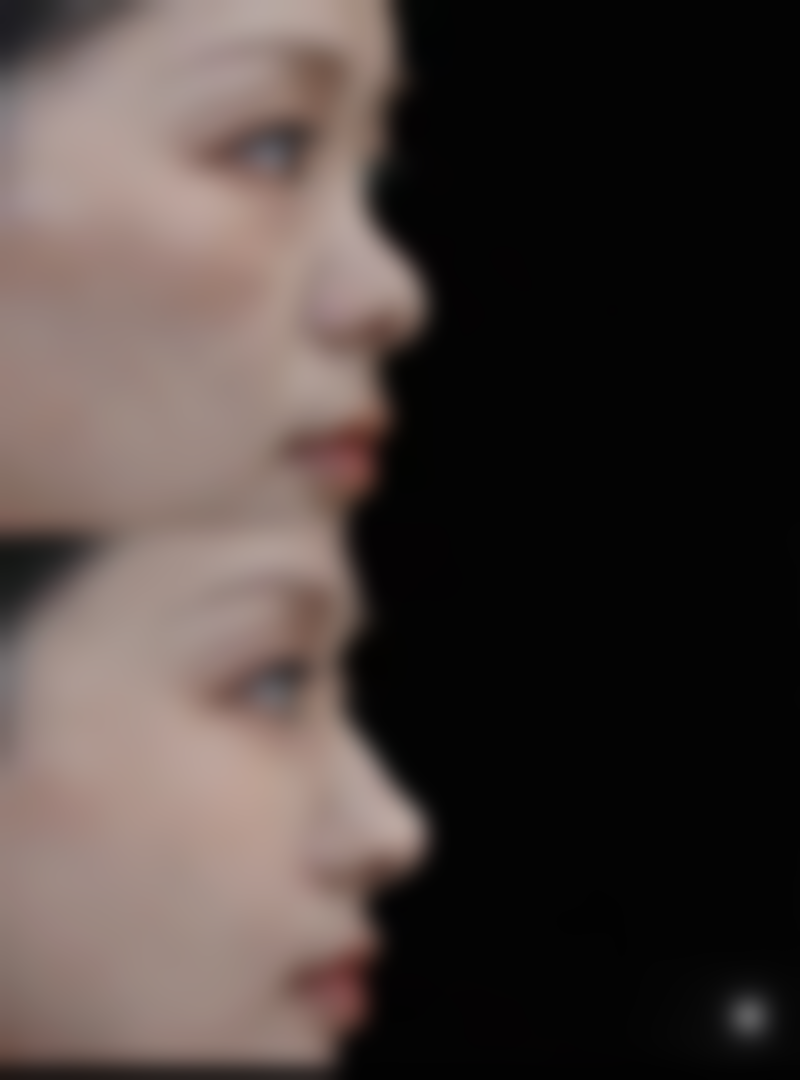 韩国摩兹（modsclinic）整形医院预约挂号方式