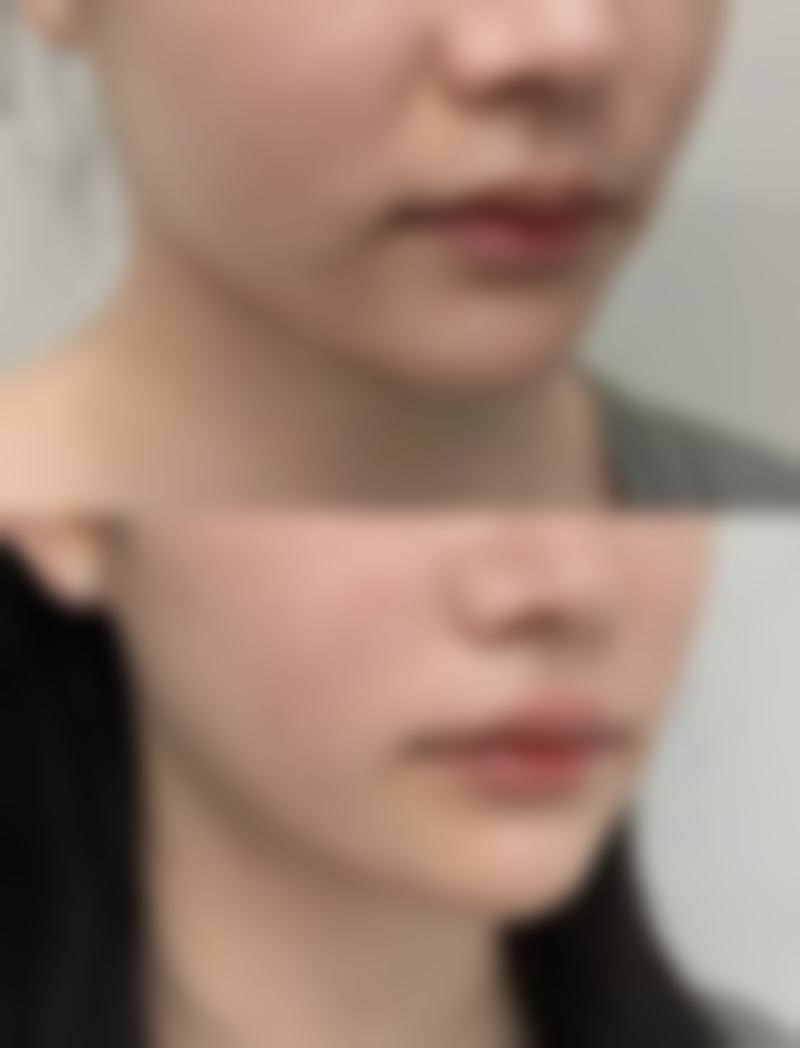 俞安娜院长怎么预约挂号——多种方式超便捷