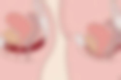 甄琳医生技术特点