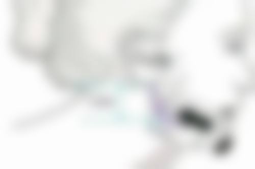 陈琳森医生真实实例