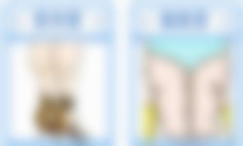 日常如何预防眼睛出现眼袋和皱纹