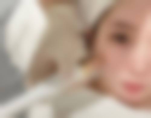 纹发技术适合毛囊不够的人吗