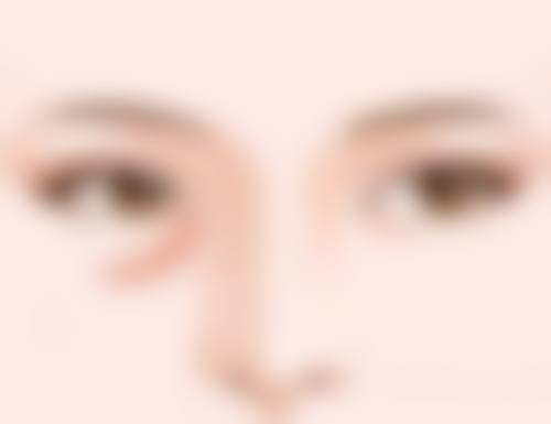 医美祛眼袋和除皱值不值