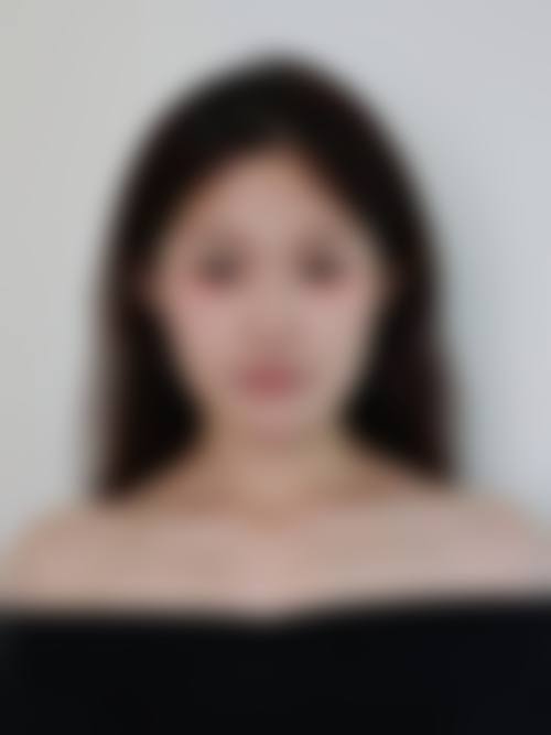 邢台李学英整形医院价格表