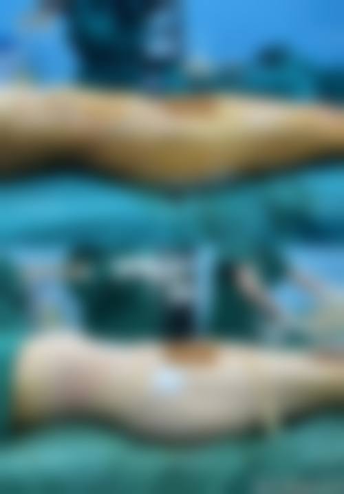 深圳千郡医疗美容诊所真实实例