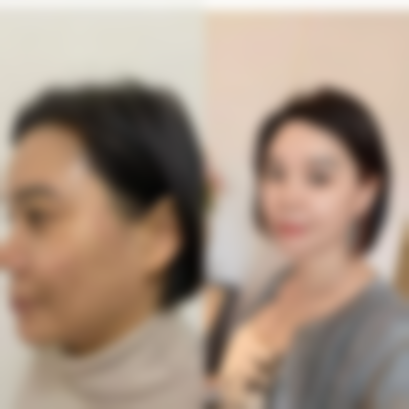 医美祛眼袋和除皱适合所有人吗