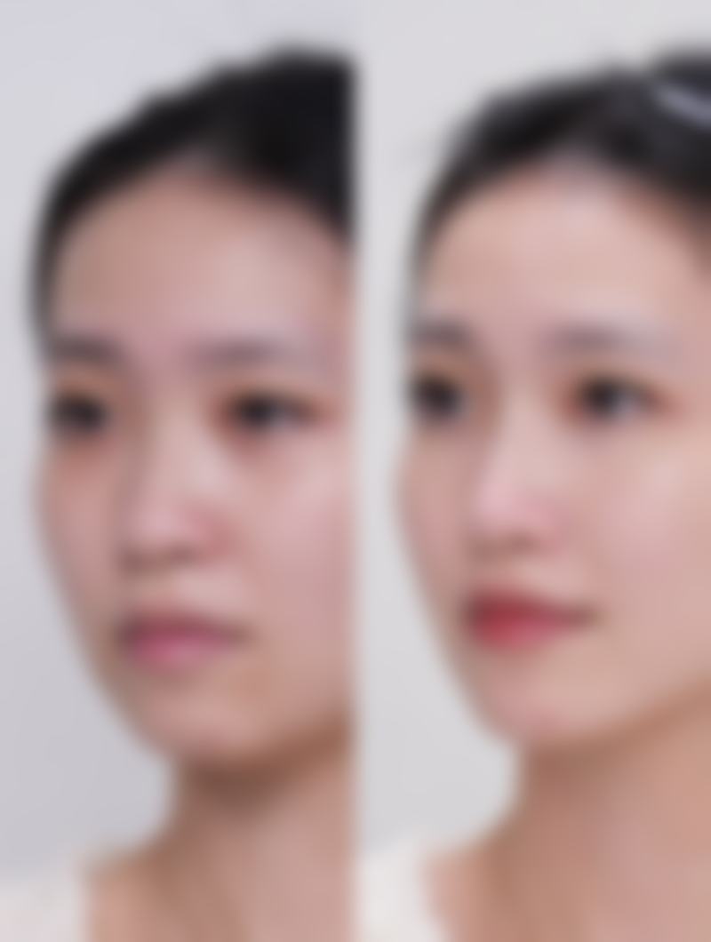 广州洛萱医疗美容门诊部擅长项目