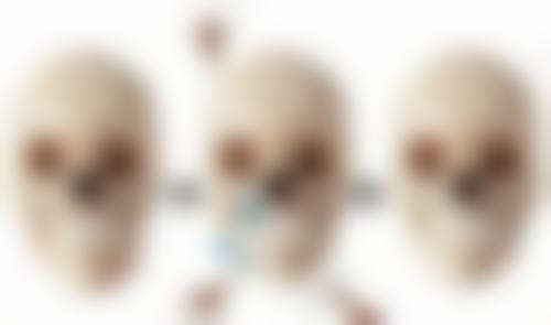 激光去眼袋和溶脂去眼袋哪个好