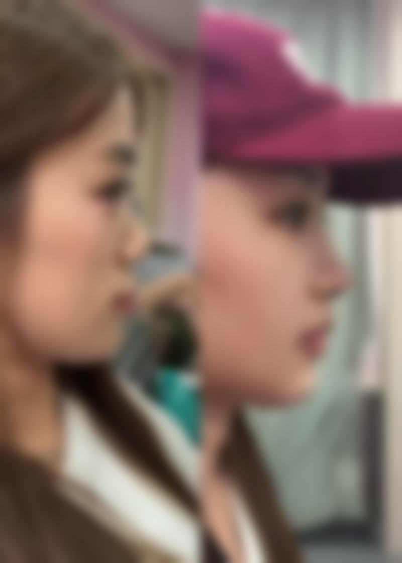 衡阳唯忆美整形医院擅长项目