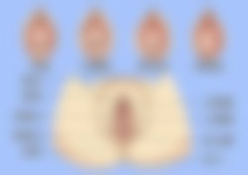 宋致勋医生技术特点：精细、创新、效率高