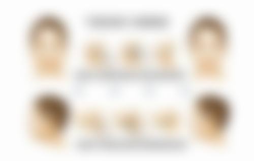 割双眼皮术前忌服活血药物怎么样