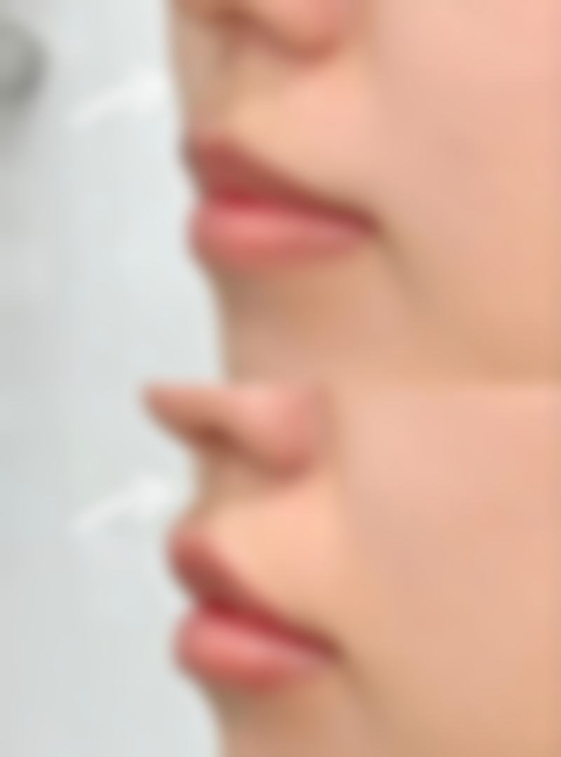 陈美运医生技术特点