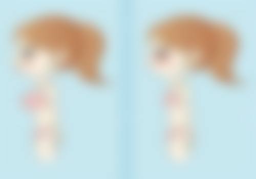 激光去眼袋消除大眼袋成效怎么样?