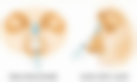 4mm针头打瘦脸针适合吗