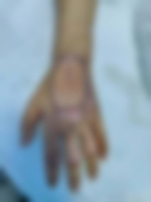 西昌汇美天丽医疗美容诊所口碑怎么样