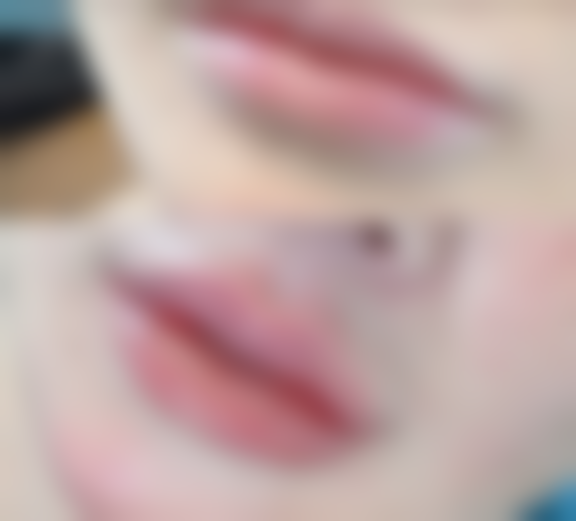 日常护理消除大眼袋哪种方法更有成效?