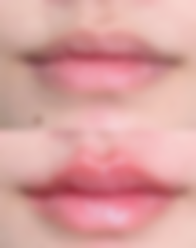 李弦医生真实实例