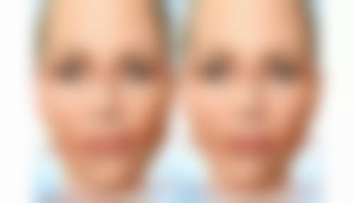 黎帅医生擅长项目