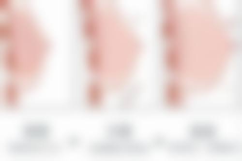 成都恒美医疗美容门诊部价格表：透明合理消费