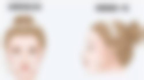 艾条去除眼袋的原理怎么样