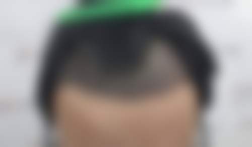 郑州元素美学整形医院擅长项目