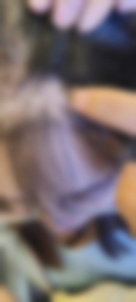 郑州元素美学整形医院真实实例