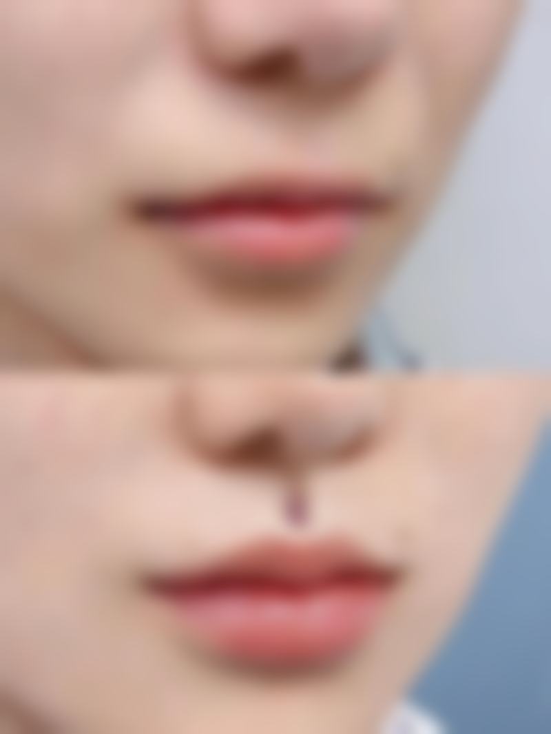 西安美好整形美容医院营业时间:随时等你来变得更美