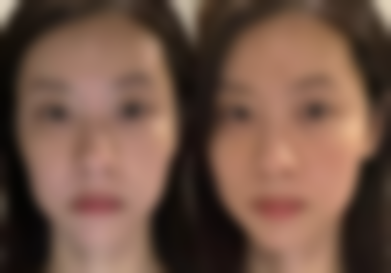 lames皮肤科口碑怎么样