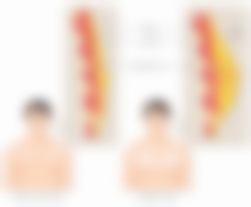 牛奶泡姜片去眼袋适合所有人吗