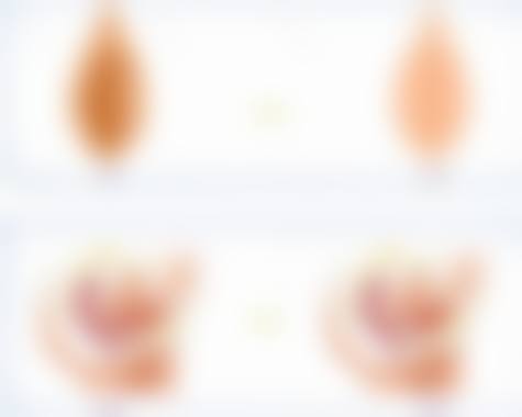 韩国林克 link 整形外科擅长项目