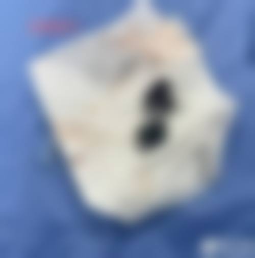 仙桃悦美整形医疗美容门诊部预约挂号方式