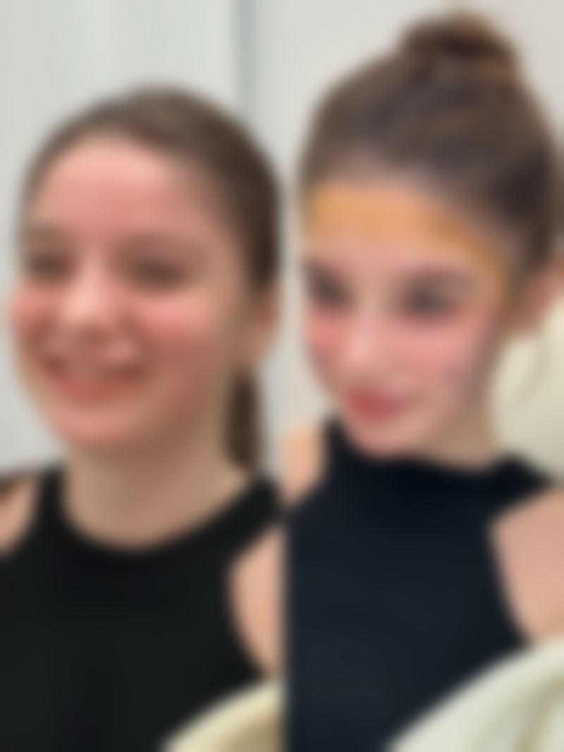 割双眼皮术后忌辛辣食物值不值？