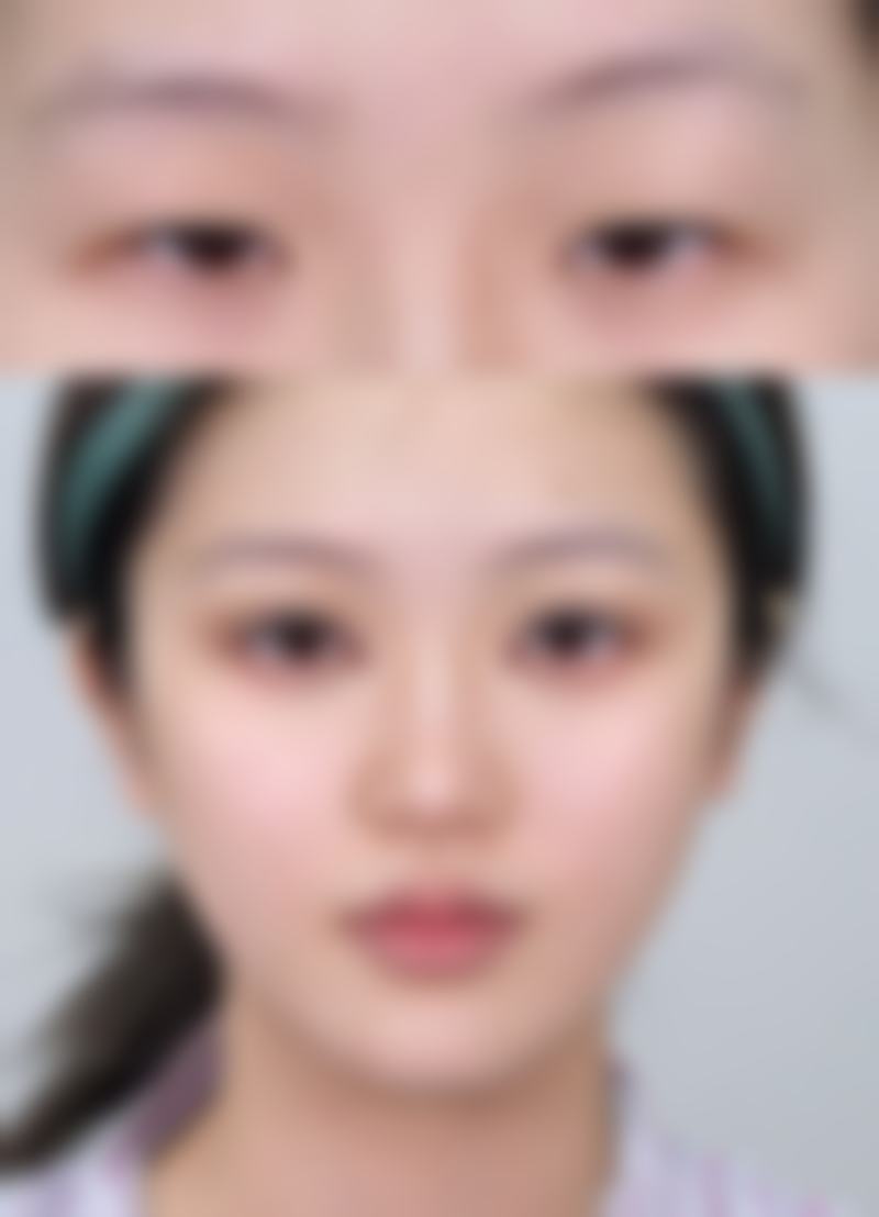 怎样用牛奶泡姜片去眼袋成效更好