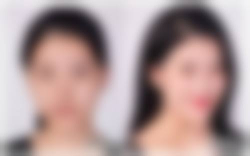 李凤华医生（超声领域）真实实例