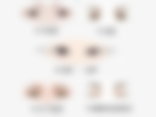 打完除皱7天后化妆就一定安心吗？