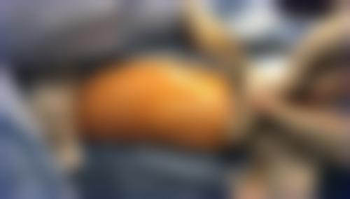 韩国JSTAR整形医院营业时间：贴心安排等你来