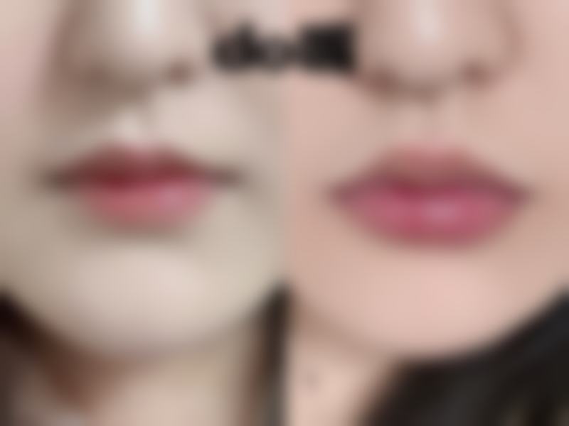 李志敏医生的医美擅长项目